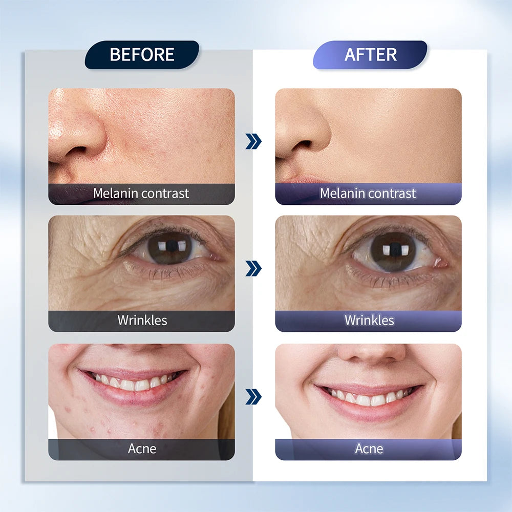 LumiVita LED Skin Rejuvenation Machine